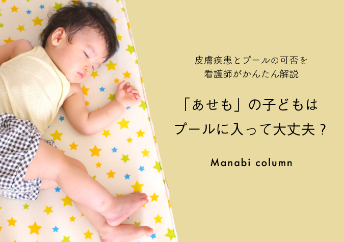 あせも
